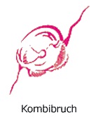 steinschlag-kombibruch